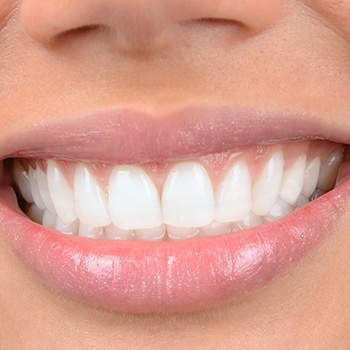 Closeup of healthy smile