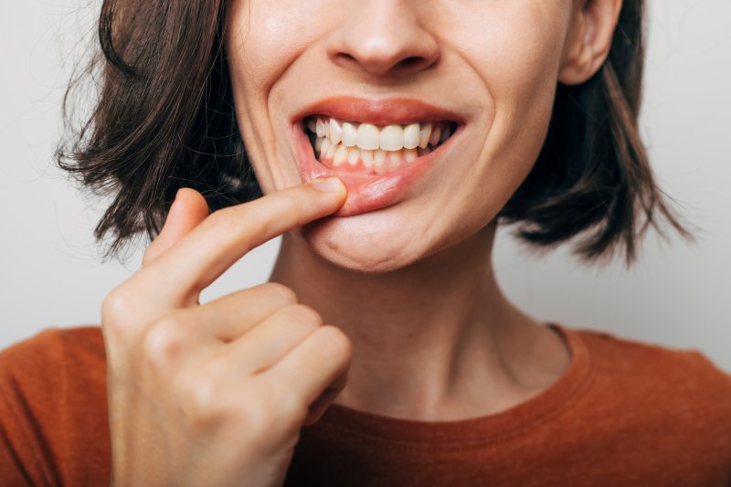 A woman revealing her slightly inflamed gums